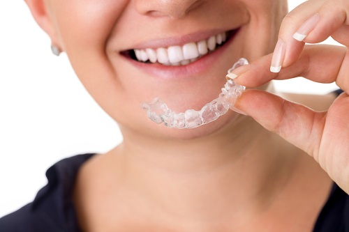 Can Invisalign Invisible Braces Hold the Key to Unlocking Your Smile?